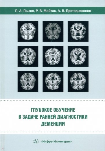 Глубокое обучение в задаче ранней диагностики деменции. Монография