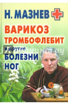 Варикоз, тромбофлебит и другие болезни ног - Николай Мазнев