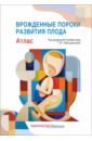 Врожденные пороки развития плода. Атлас - Абильдинова Гульшара Жусуповна, Абаева А. С., Боровикова А. В.