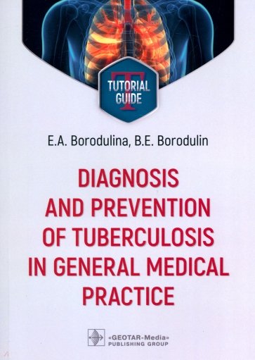 Diagnosis and prevention of tuberculosis in general medical practice. Tutorial guide