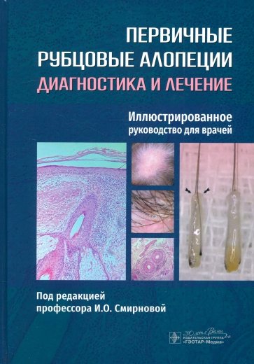 Первичные рубцовые алопеции. Диагностика и лечение. Иллюстрированное руководство для врачей