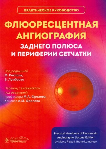 Флюоресцентная ангиография заднего полюса и периферии сетчатки