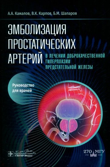 Эмболизация простатических артерий в лечении доброкачественной гиперплазии предстательной железы