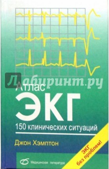 Атлас ЭКГ. 150 клинических ситуаций Медицинская литература