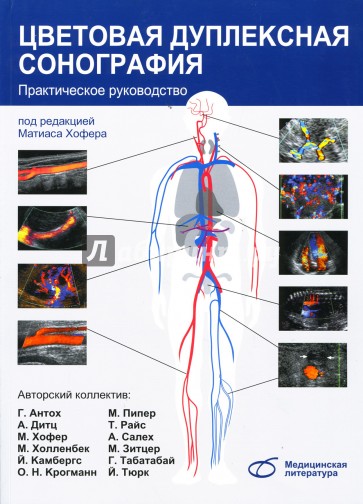 Цветовая дуплексная сонография: Практическое руководство