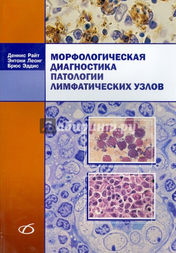 Морфологическая диагностика патологии лимфатических узлов