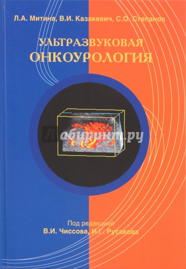 Ультразвуковая онкоурология