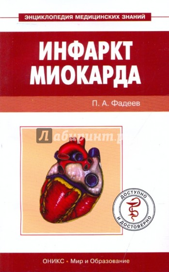 Инфаркт миокарда