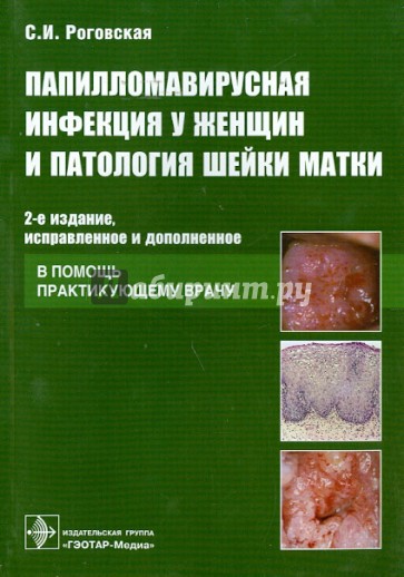 Папилломавирусная инфекция у женщин и патология шейки матки: В помощь практикующему врачу