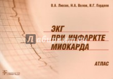 ЭКГ при инфаркте миокарда: атлас