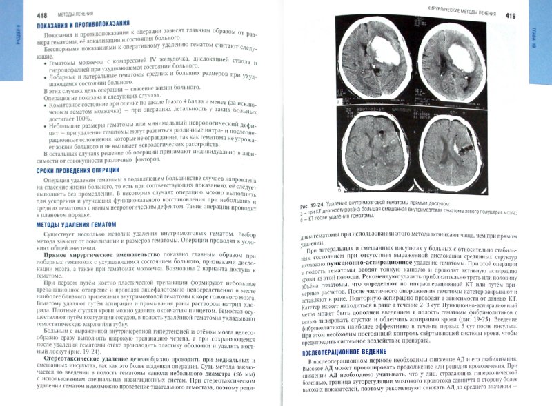 Иллюстрация 1 из 55 для Неврология: национальное руководство (+CD) | Лабиринт - книги. Источник: Лабиринт