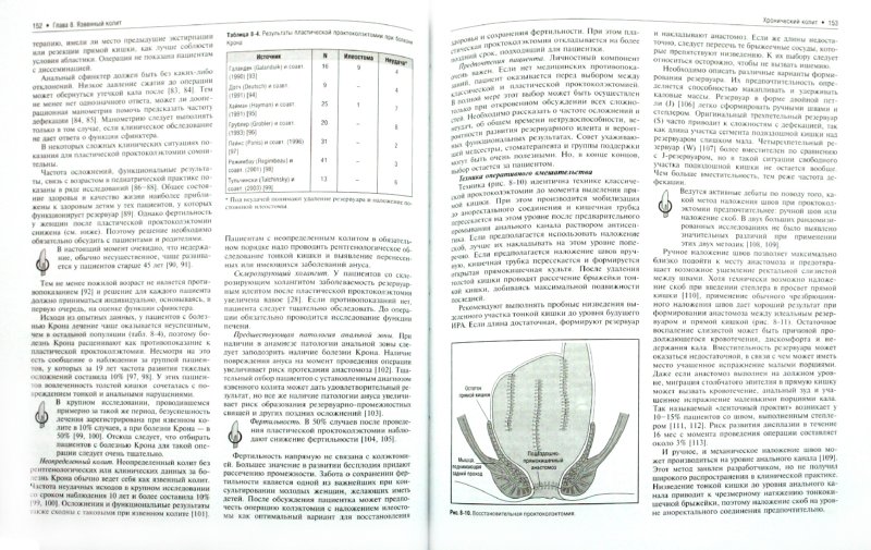 Иллюстрация 1 из 6 для Колоректальная хирургия - Филлипс Р. К. С. | Лабиринт - книги. Источник: Лабиринт