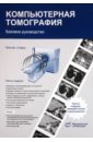 Хофер Матиас Компьютерная томография. Базовое руководство хофер матиас цветовая дуплексная сонография практическое руководство