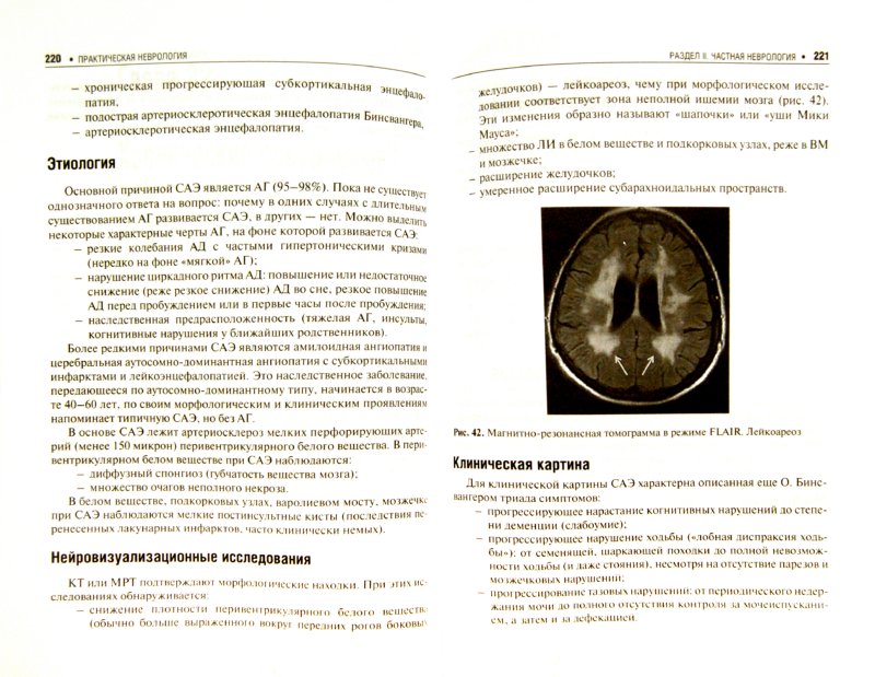 Иллюстрация 1 из 15 для Практическая неврология. Руководство для врачей - Кадыков, Манвелов, Шведков, Алексеева | Лабиринт - книги. Источник: Лабиринт
