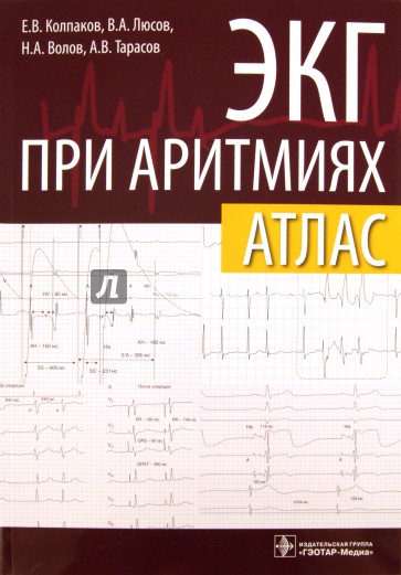 ЭКГ при аритмиях. Атлас + линейка электрокардиографическая