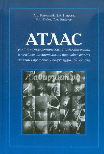 Атлас рентгеноэндоскоп. диагностич. и лечебных вмешательств при заб. желчных протоков и подж. железы