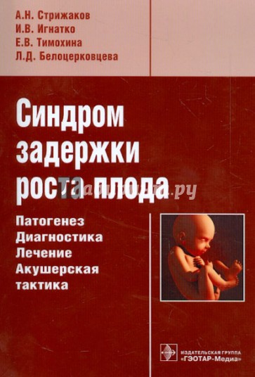 Синдром задержки роста плода. Патогенез. Диагностика. Лечение. Акушерская тактика