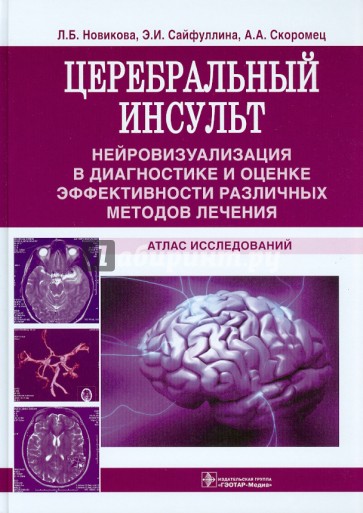 Церебральный инсульт. Атлас исследований