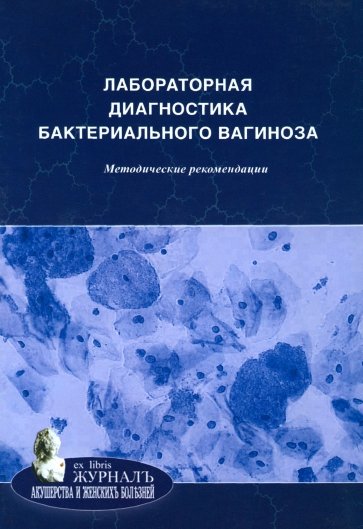 Лабораторная диагностика бактериального вагиноза. Методические рекомендации