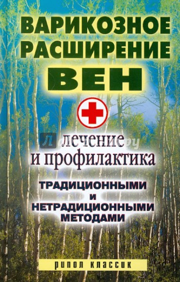 Варикозное расширение вен. Лечение и профилактика традиционными и нетрадиционными методами