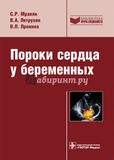 Пороки сердца у беременных