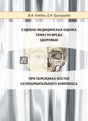 Судебно-медицинская оценка тяжести вреда здоровью при переломах костей скулоорбитального комплекса