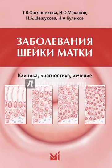 Заболевания шейки матки. Клиника, диагностика, лечение. Учебное пособие для врачей