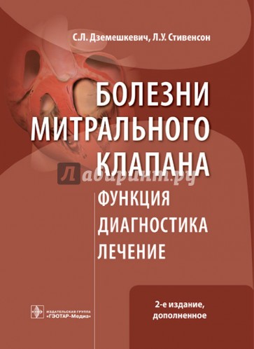 Болезни митрального клапана. Функция, диагностика, лечение