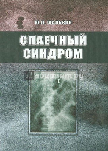 Спаечный синдром