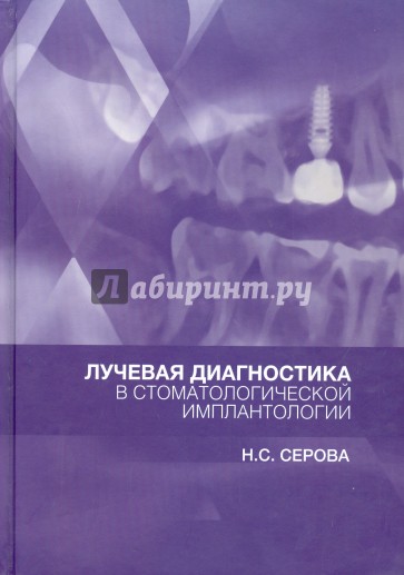 Лучевая диагностика в стоматологической имплантологии. Атлас