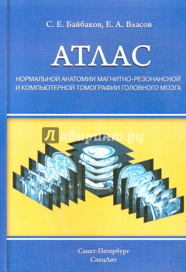 Атлас нормальной анатомии магнитно-резонансной и компьютерной томографии головного мозга