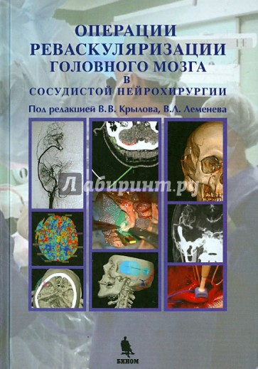 Операции реваскуляризации головного мозга в сосудистой нейрохирургии