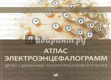 Атлас электроэнцефалограмм детей с различной патологией головного мозга
