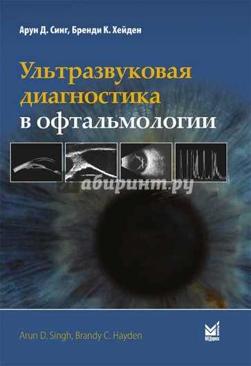 Ультразвуковая диагностика в офтальмологии