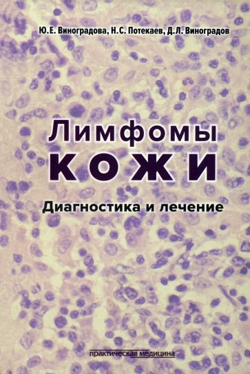 Лимфомы кожи. Диагностика и лечение