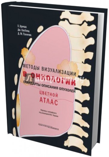 Методы визуализации в онкологии. Стандарты описания опухолей. Цветной атлас