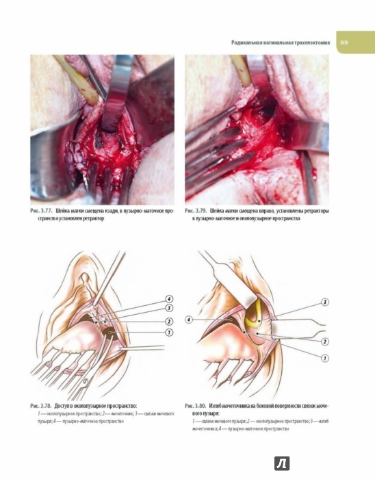 ������ ������� ������� �����, ����� ����� �� � ��������