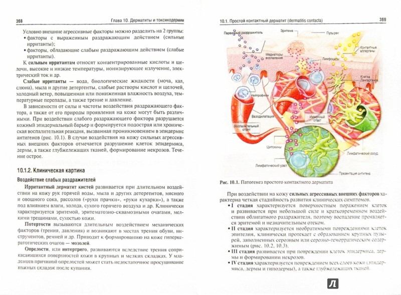 Иллюстрация 1 из 62 для Дерматовенерология. Учебник - Чеботарев, Асхаков | Лабиринт - книги. Источник: Лабиринт