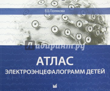 Атлас электроэнцефалограмм детей