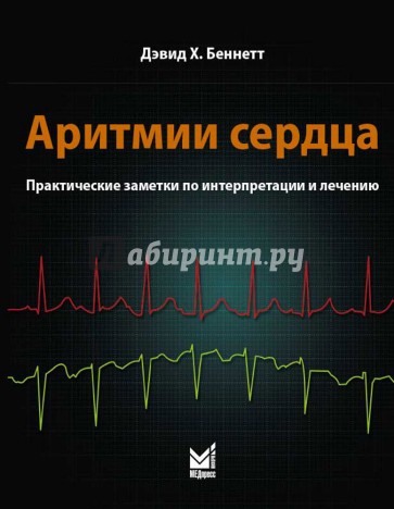 Аритмии сердца