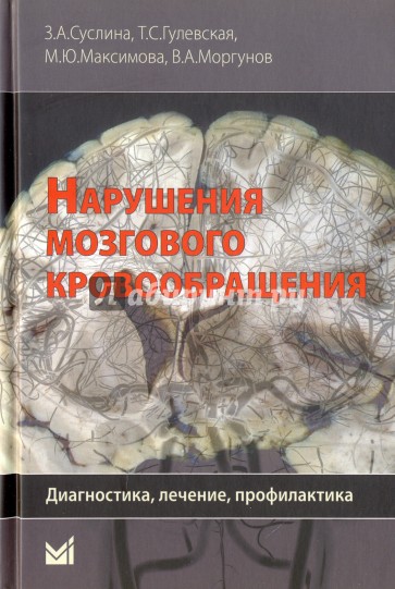 Нарушения мозгового кровообращения: диагностика, лечение, профилактика