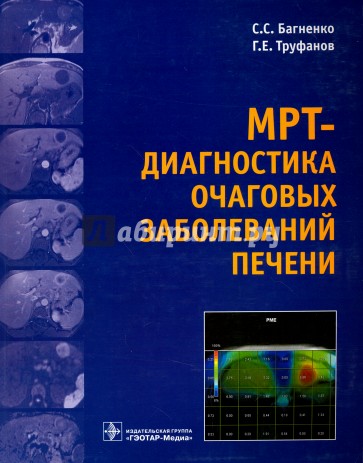 МРТ-диагностика очаговых заболеваний печени