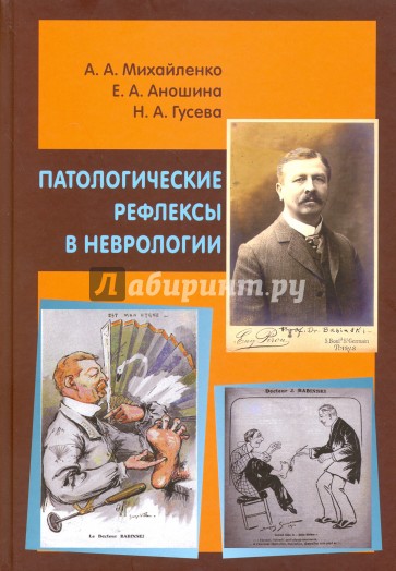 Патологические рефлексы в неврологии