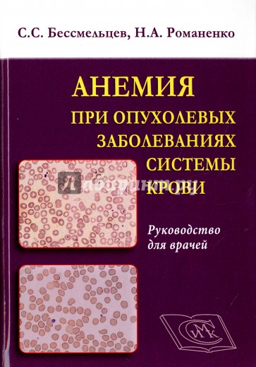 Анемия при опухолевых заболеваниях системы крови. Руководство для врачей