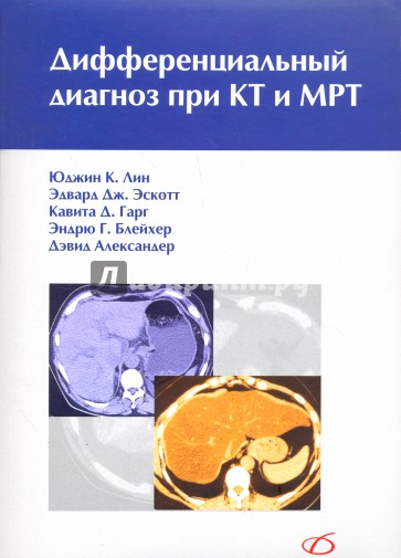 Дифференциальный диагноз при КТ и МРТ