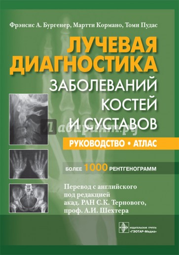 Лучевая диагностика заболеваний костей и суставов