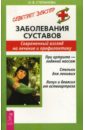 Степанова Ольга Васильевна Заболевания суставов. Современный взгляд на лечение и профилактику казакова ольга сколиоз современный взгляд на лечение и профилактику