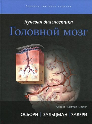 Лучевая диагностика. Головной мозг