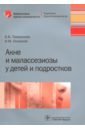 Тамразова Ольга Борисовна, Османов Исмаил Магомедович Акне и малассезиозы у детей и подростков акне и малассезиозы у детей и подростков