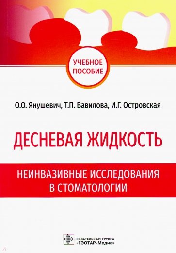 Десневая жидкость. Неинвазивные исследования